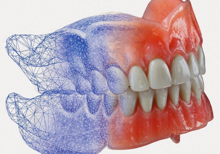 Digital Dentures